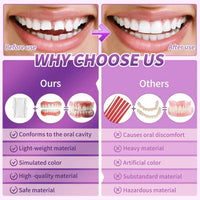 Comfort Fit Silicone Dentures for Instant Smile