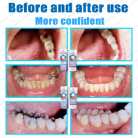 Advanced Dental Repair and Cavity Removal Treatment
