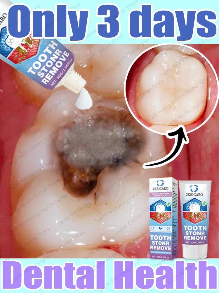 Advanced Dental Repair and Cavity Removal Treatment