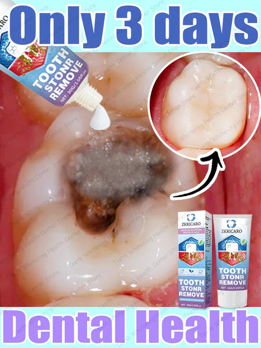 Advanced Dental Repair and Cavity Removal Treatment