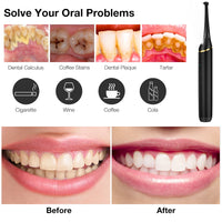 Electric Sonic Dental Calculus Remover for Teeth Whitening