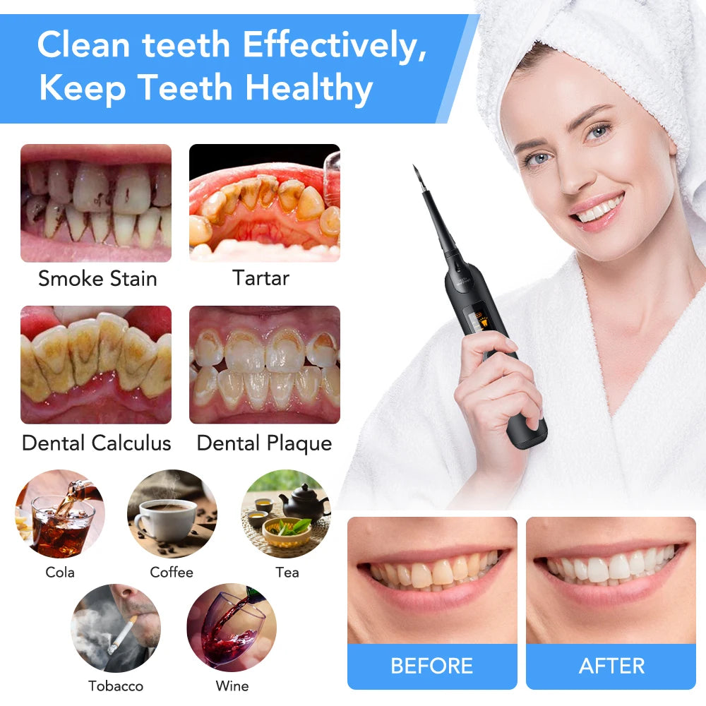 Electric Sonic Dental Calculus Remover for Professional Teeth Whitening - 9