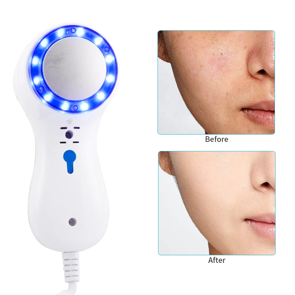 Cold Hammer Skin Cooling & Photon Therapy Device - 15