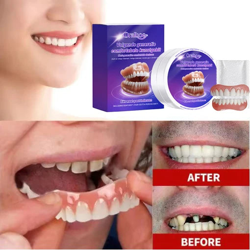 Flexible Cosmetic Denture Set for Natural Smile - 1