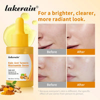 Brightening Kojic Acid and Turmeric Face Serum