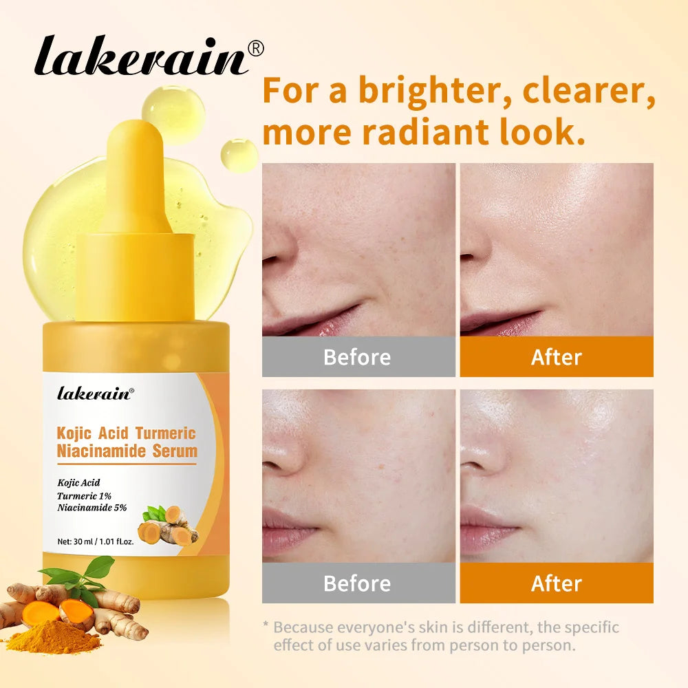 Brightening Turmeric and Kojic Acid Face Serum - 3