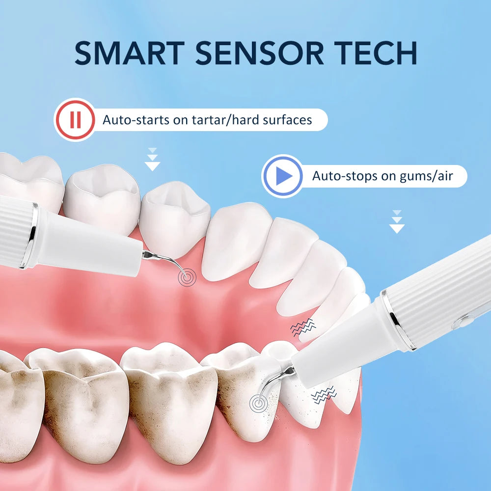 Visual Ultrasonic Tooth Plaque and Tartar Remover - 4