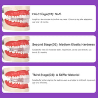 Complete Ultrasonic Dental Care & Teeth Whitening System