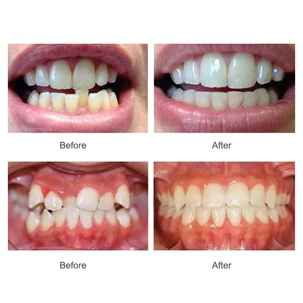 Complete Ultrasonic Dental Care & Teeth Whitening System - 21