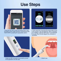 Visible Tonsil Stone Remover with HD Camera