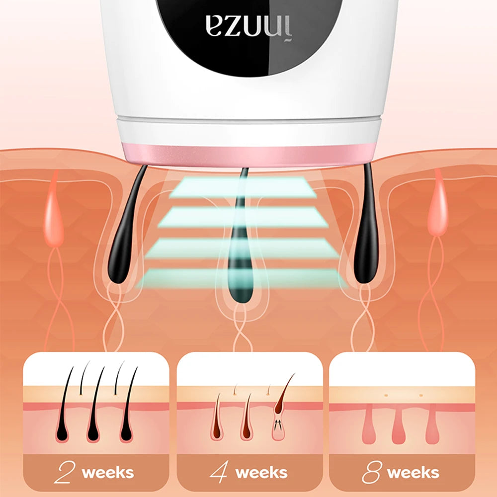 At-Home IPL Laser Hair Removal Device - 3