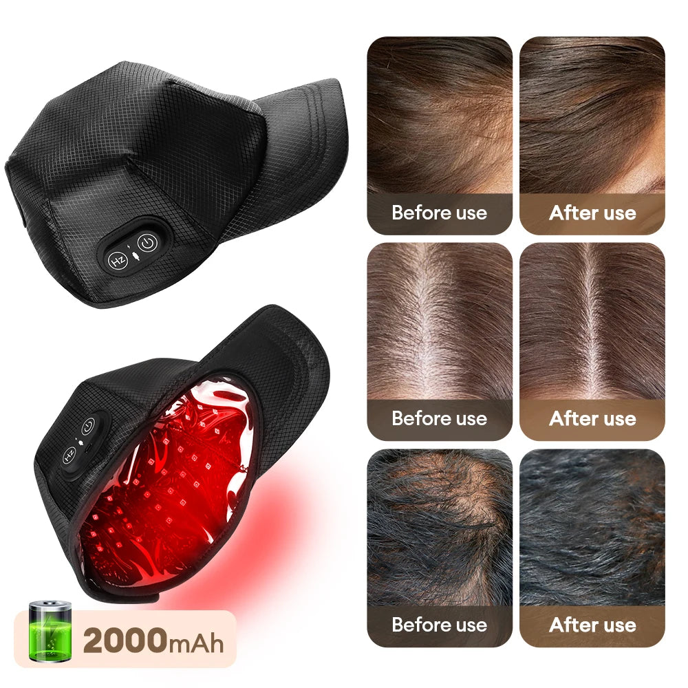 Red Light Therapy Hair Regrowth Cap - 2