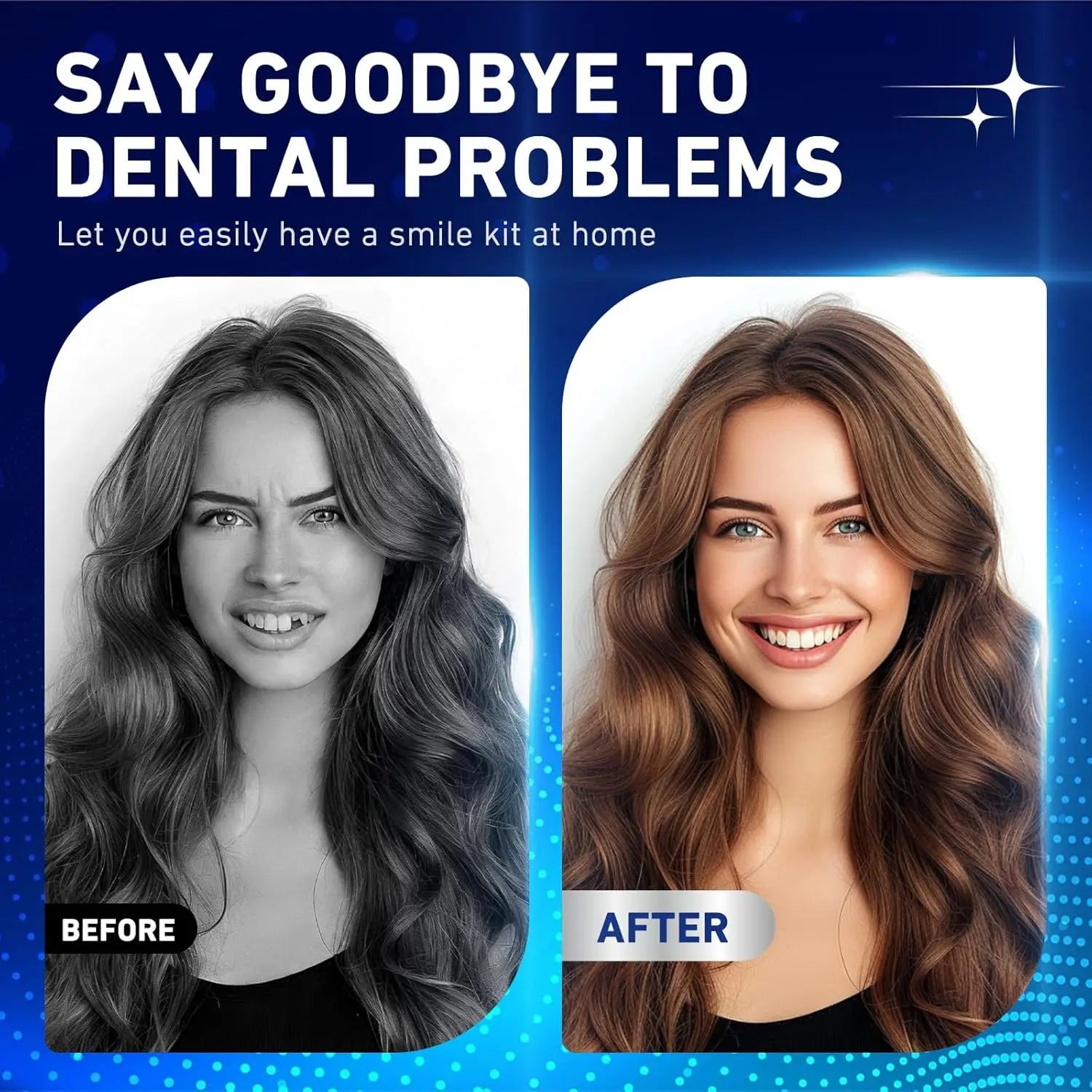 Comfort Fit Cosmetic Teeth Veneers - 4