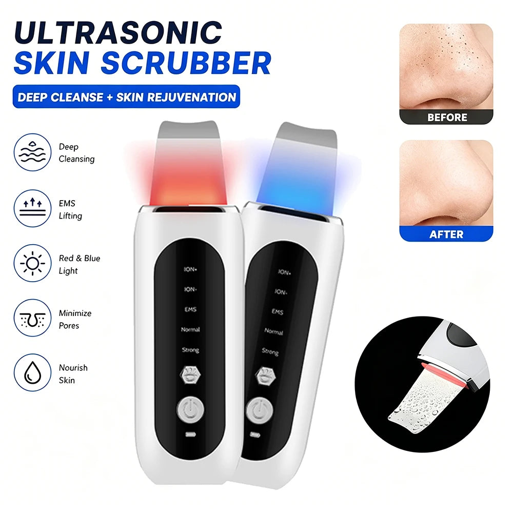 Ultrasonic Facial Skin Scrubber for Deep Pore Cleaning - 1