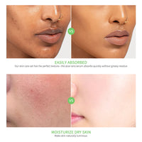 Soothing Aloe Vera Hydrating Face Gel