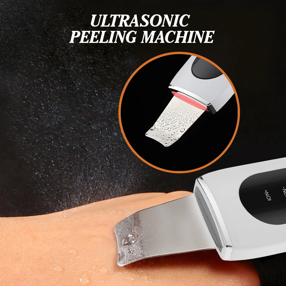 Ultrasonic Facial Skin Scrubber and Pore Cleaner - 4