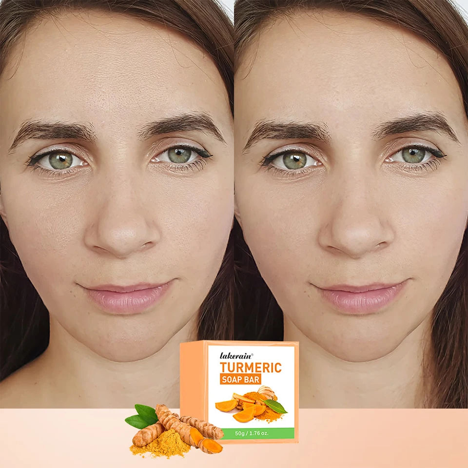 Brightening Turmeric Soap Bar for Face and Body - 10