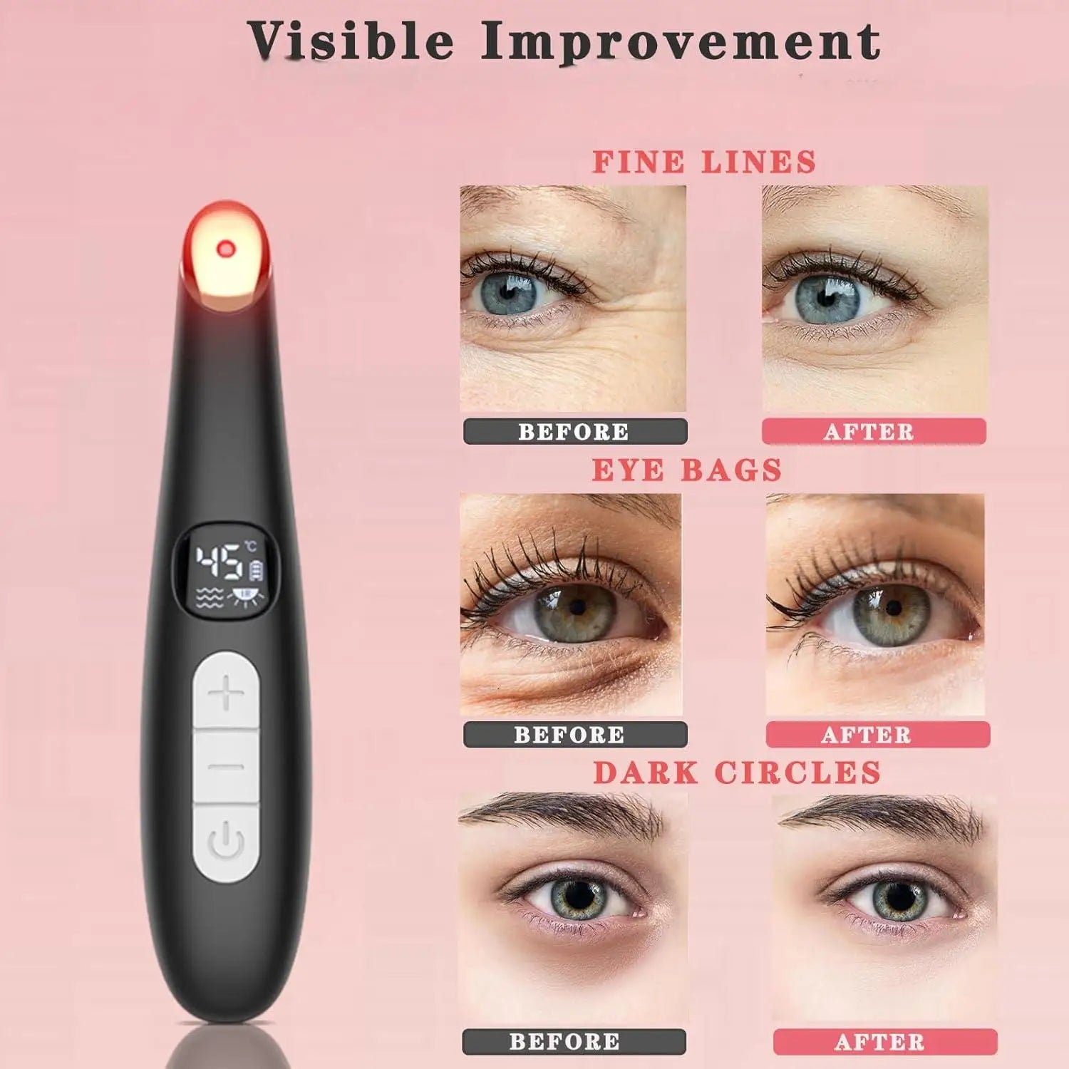 3-in-1 Heated Eye & Face Rejuvenation Wand - 2