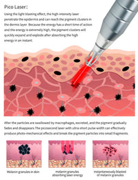 Professional Picosecond Laser Tattoo and Skin Rejuvenation Machine