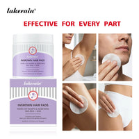 Exfoliating Ingrown Hair & Razor Bump Treatment Pads
