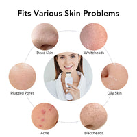 Ultrasonic Facial Skin Scrubber and Pore Cleaner