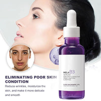 Niacinamide Vitamin B3 Brightening Face Serum for Dark Spots