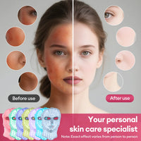 7-Color Photon LED Face and Neck Rejuvenation Mask