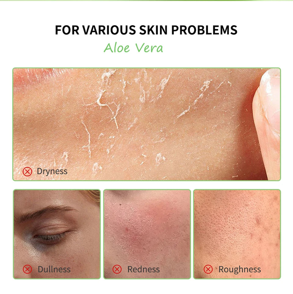 Soothing Aloe Vera Hydrating Face Gel - 8