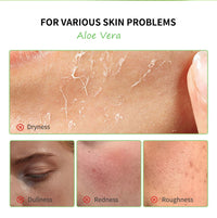 Soothing Aloe Vera Hydrating Face Gel