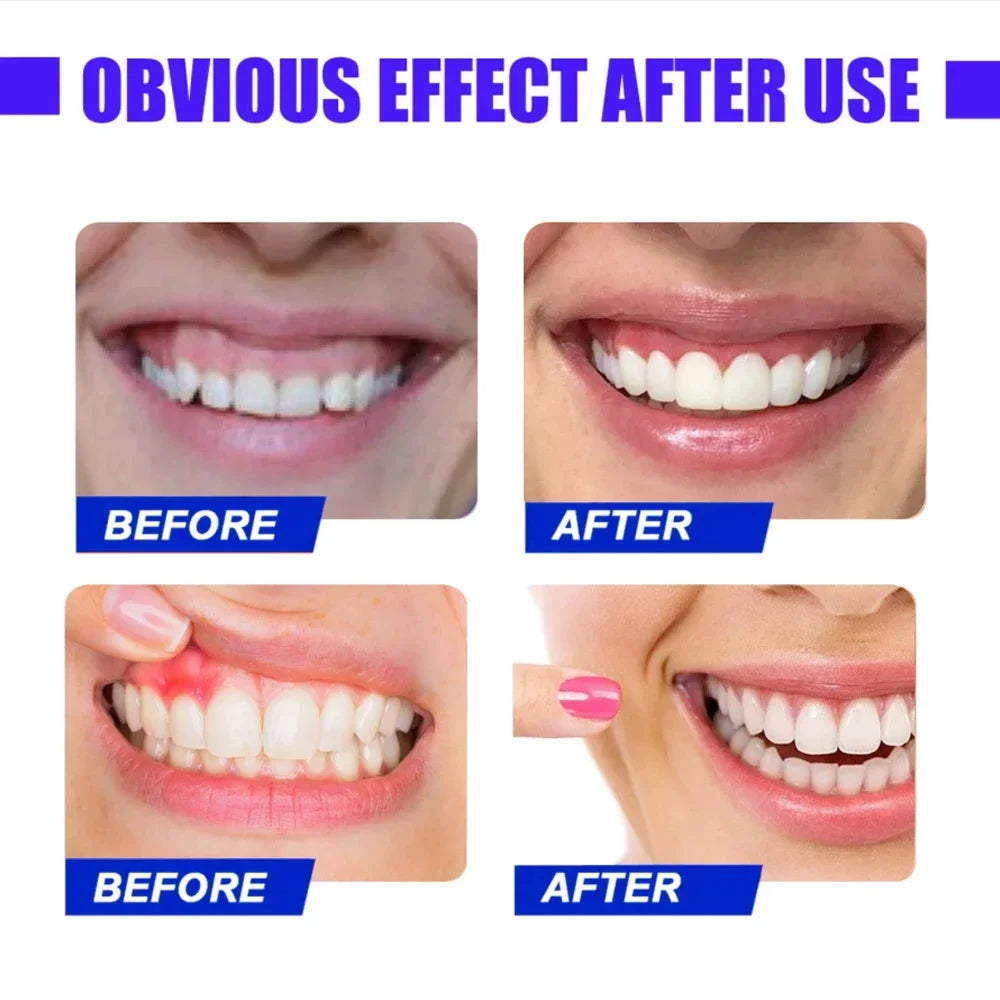 LED Red Light Oral Therapy Device for Gum Pain & Tooth Sensitivity - 10