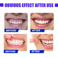 LED Red Light Oral Therapy Device for Gum Pain & Tooth Sensitivity