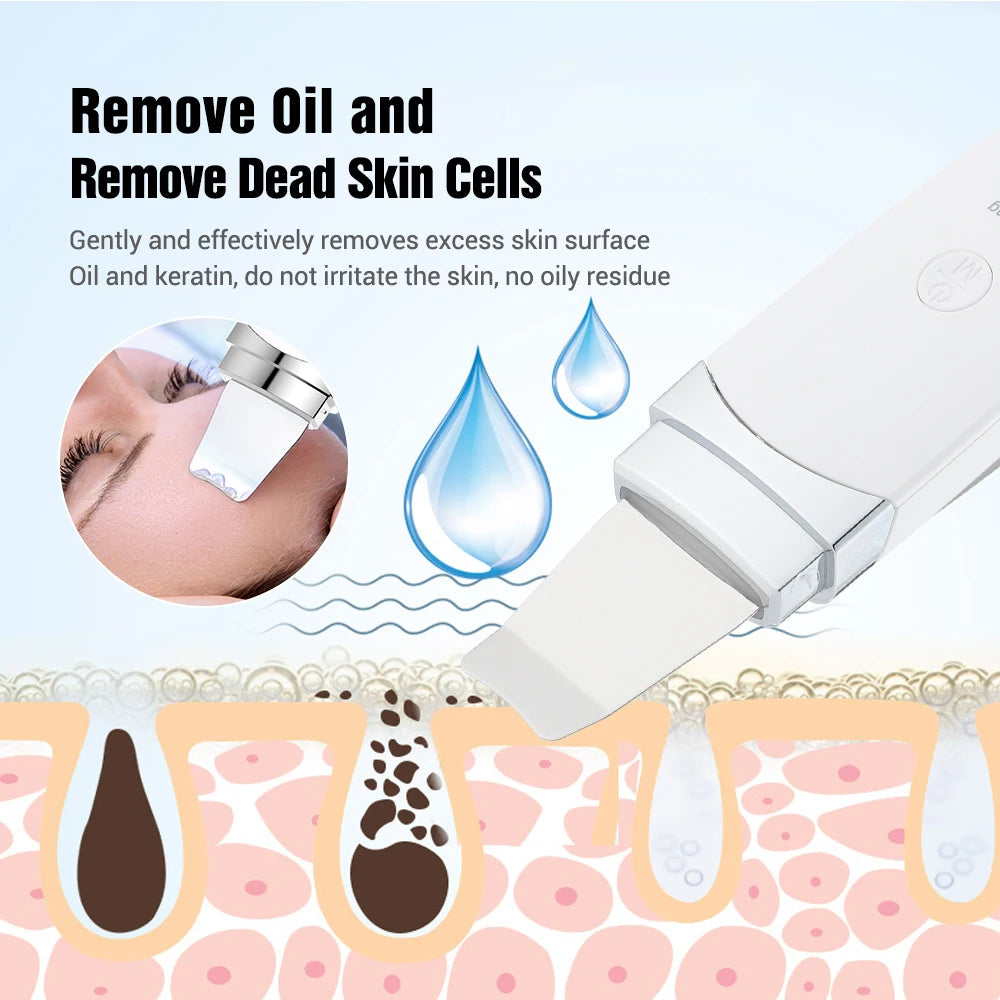 Ultrasonic Facial Skin Scrubber and Pore Cleaner - 33