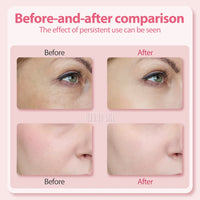4-in-1 LED Facial Massage Wand for Anti-Aging & Skin Tightening