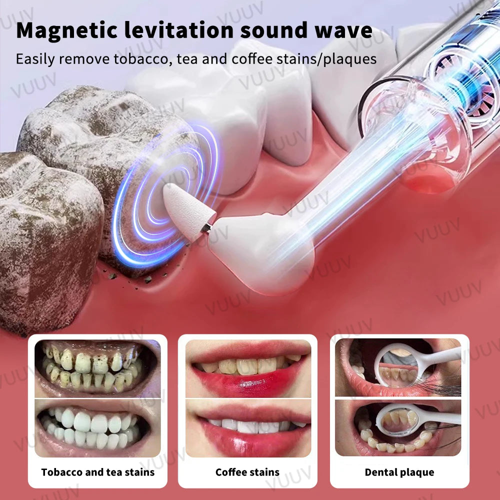 Electric Teeth Polishing and Stain Removal Kit - 2
