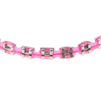 Fashionable Cosmetic Faux Braces for Parties and Cosplay
