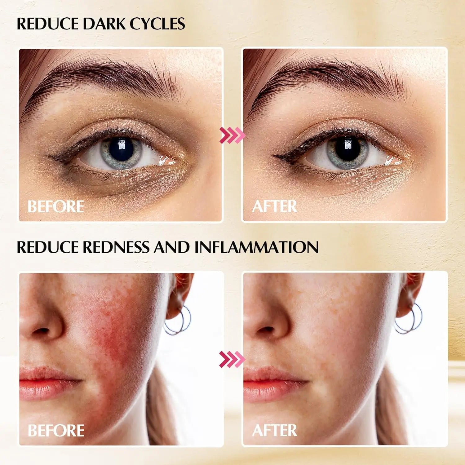 Stainless Steel Cooling Facial Cryo Sticks for Skin Tightening - 5