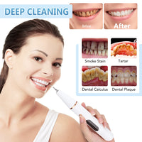 Electric Ultrasonic Teeth Cleaner for Plaque and Tartar Removal