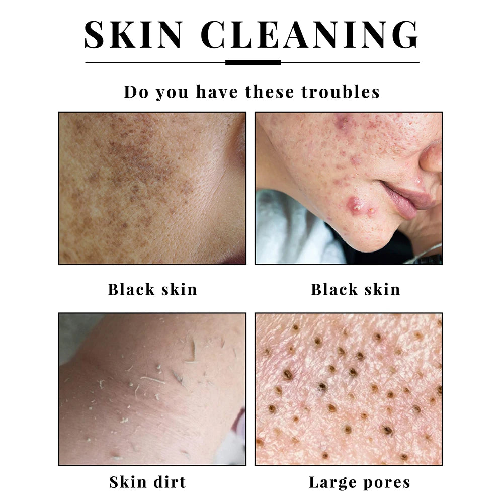 Brightening Kojic Acid Exfoliating Soap for Face and Body - 8