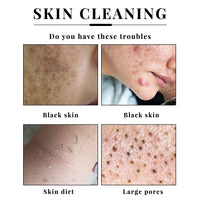 Brightening Kojic Acid Exfoliating Soap for Face and Body