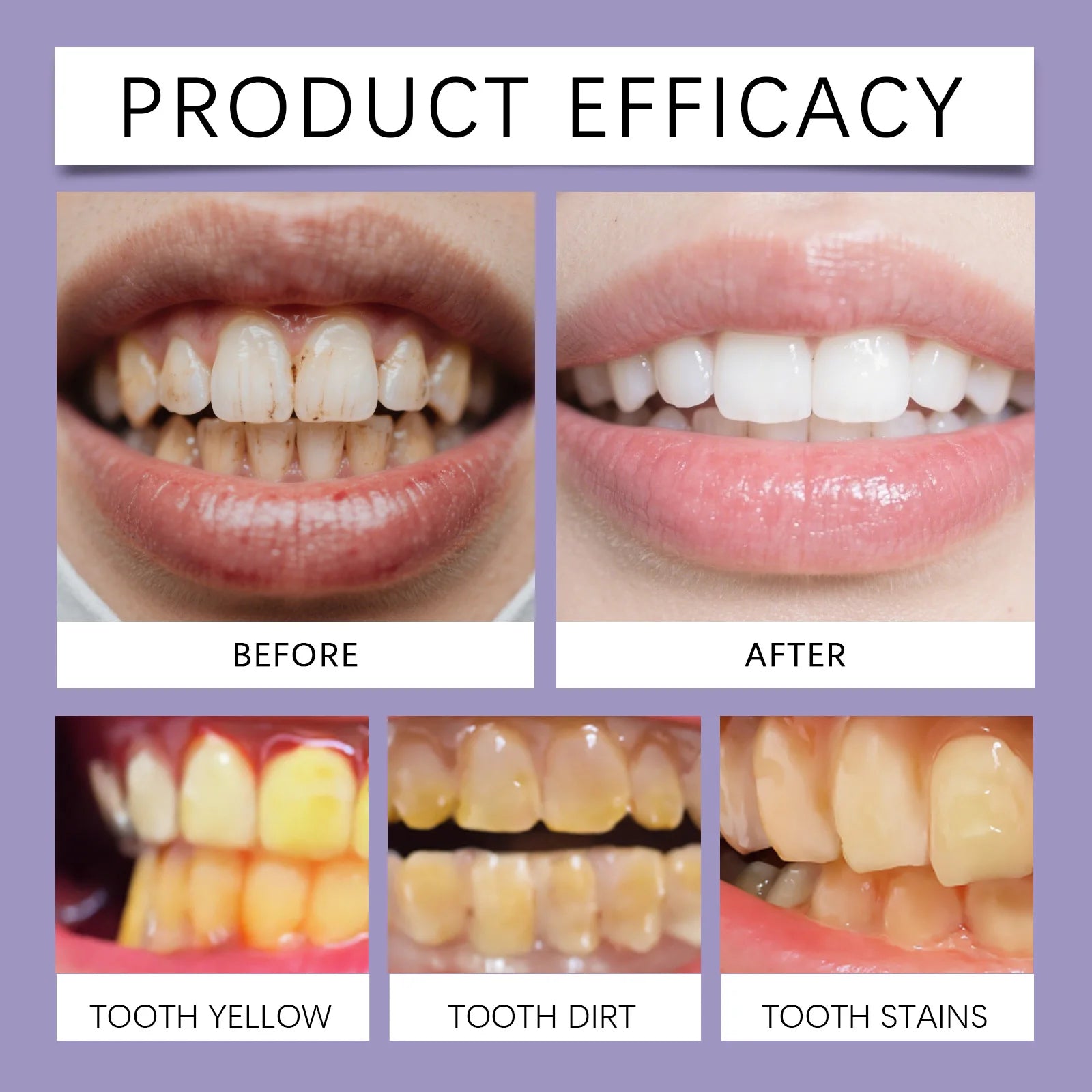 Purple Teeth Whitening Mousse Foam for Deep Stain Removal - 8