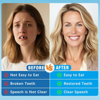 Comfort Fit Realistic Silicone Cosmetic Dentures