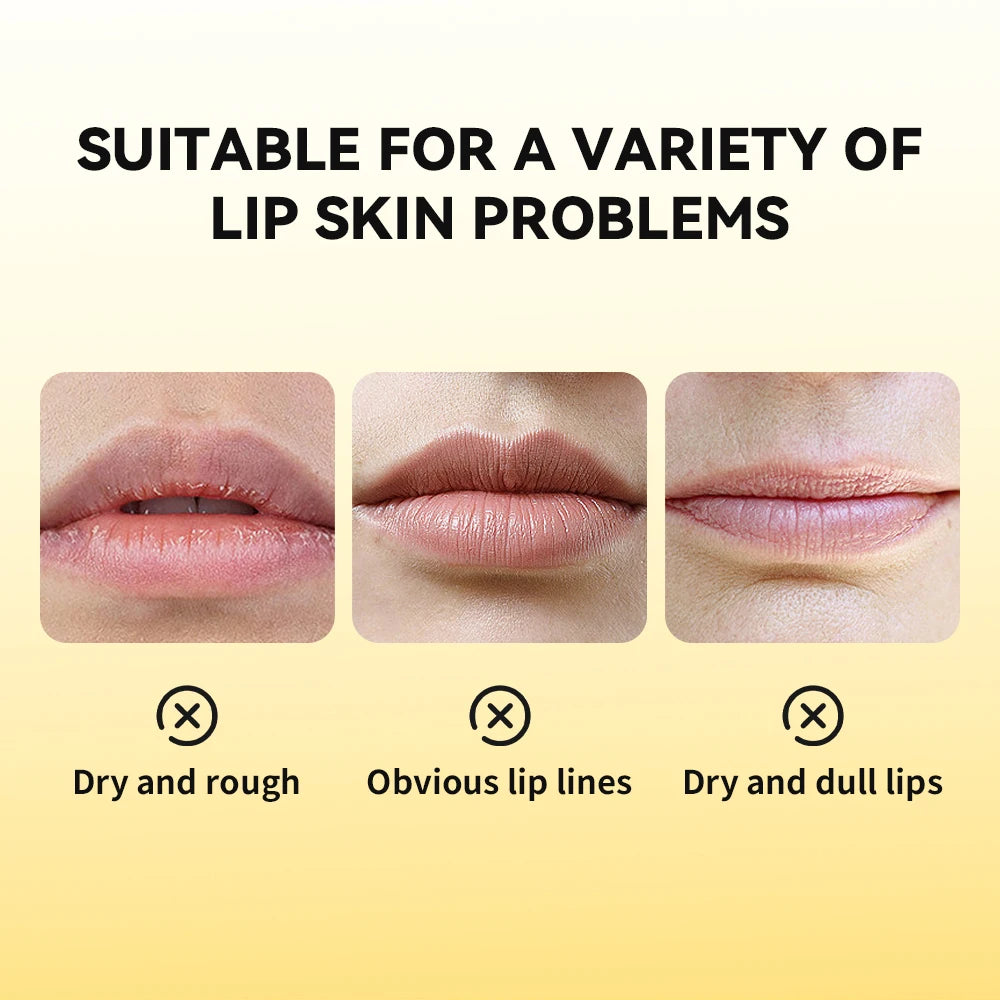 Propolis Hydrating Honey Lip Repair Gel - 5