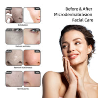 3-in-1 Professional Diamond Microdermabrasion Facial Machine