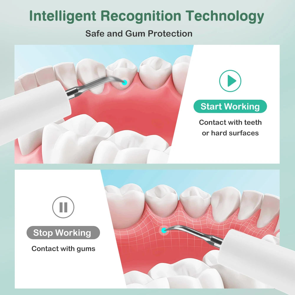 Ultrasonic Electric Teeth Tartar and Plaque Remover - 12
