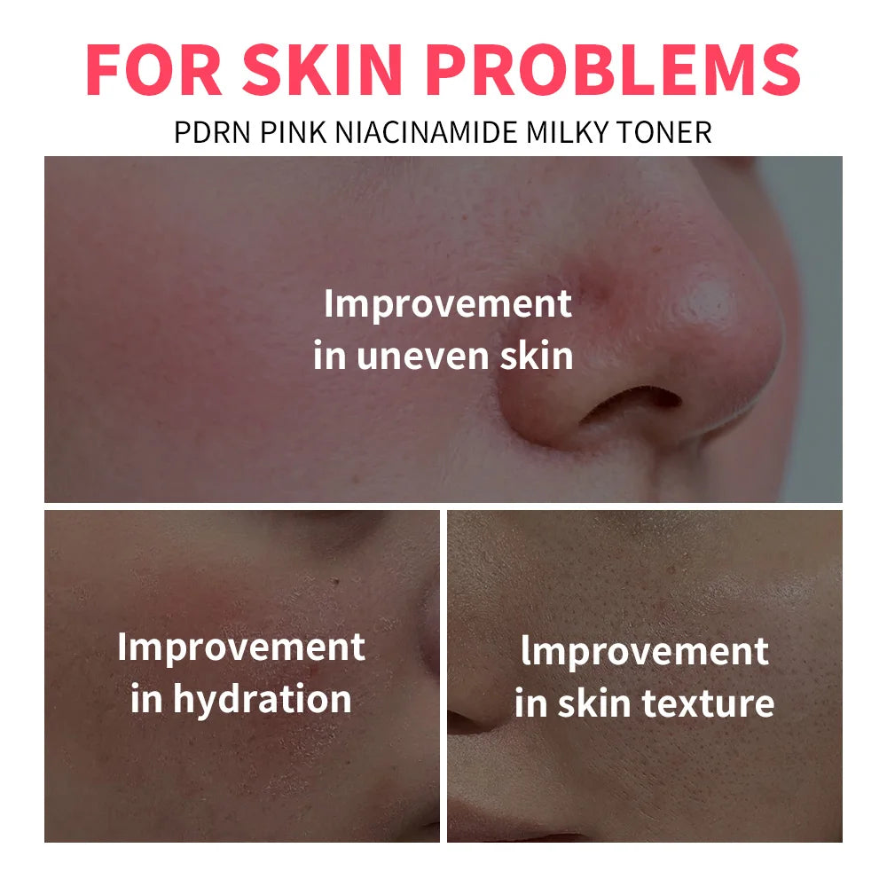 PDRN Niacinamide Milky Toner for Radiant Hydrated Skin - 6