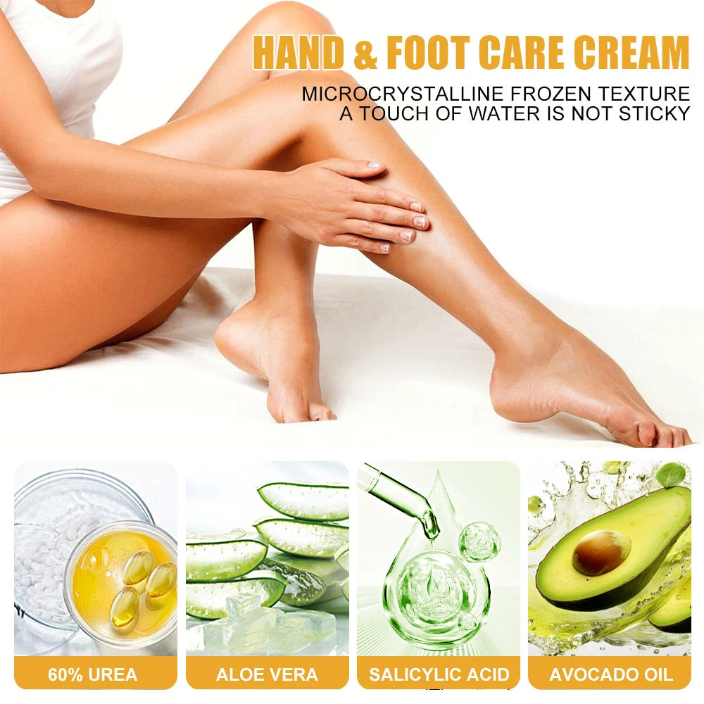Electric Callus Remover & Repair Cream Kit for Smooth Heels - 14