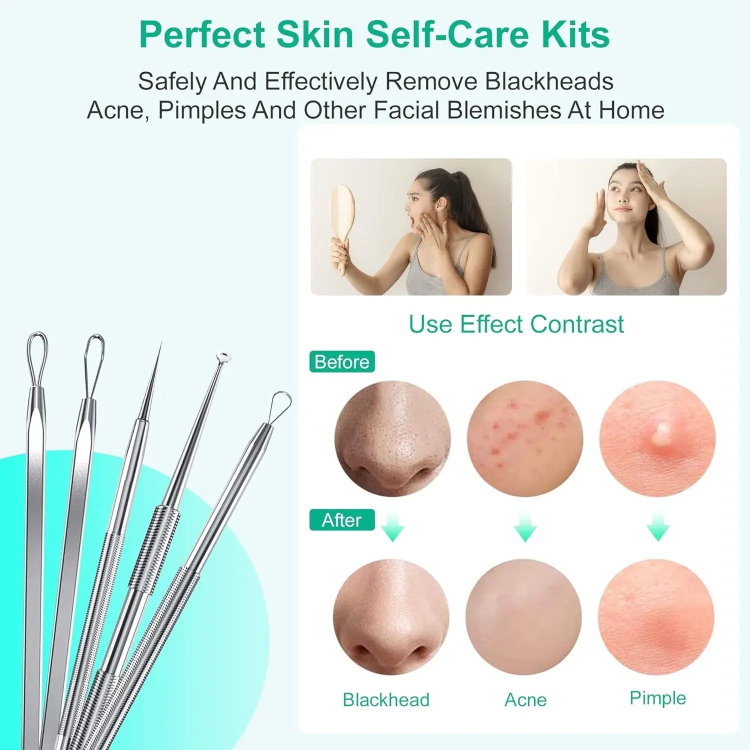 5-Piece Stainless Steel Blackhead and Acne Removal Kit - 4