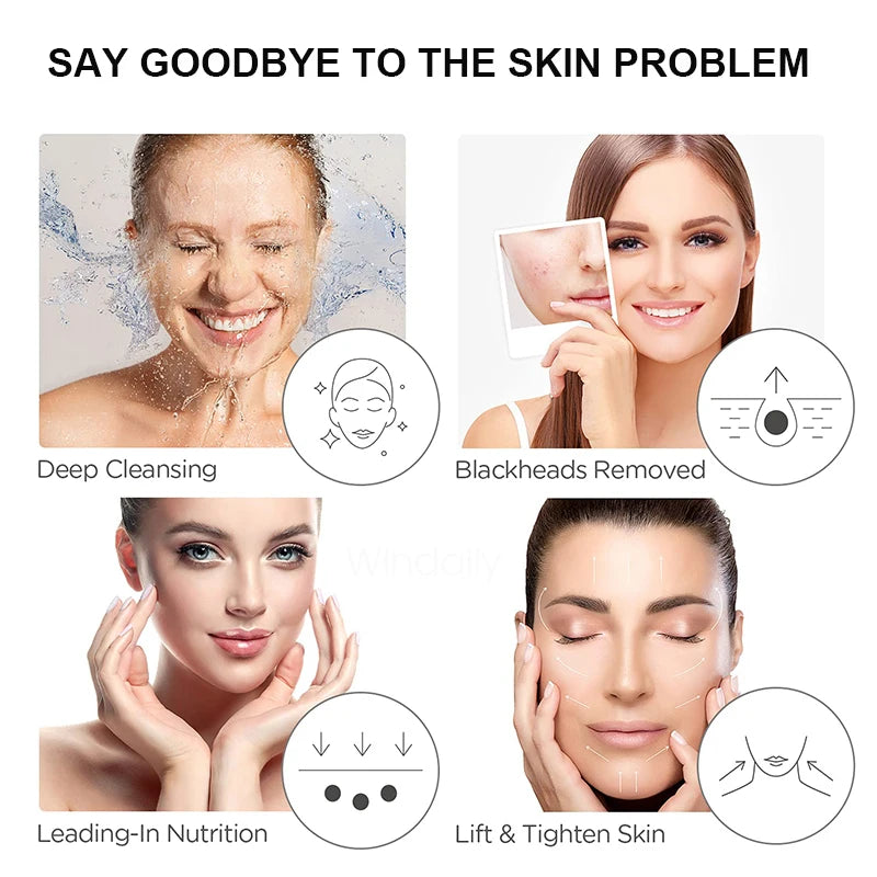Ultrasonic Facial Skin Scrubber and Pore Cleaner - 14