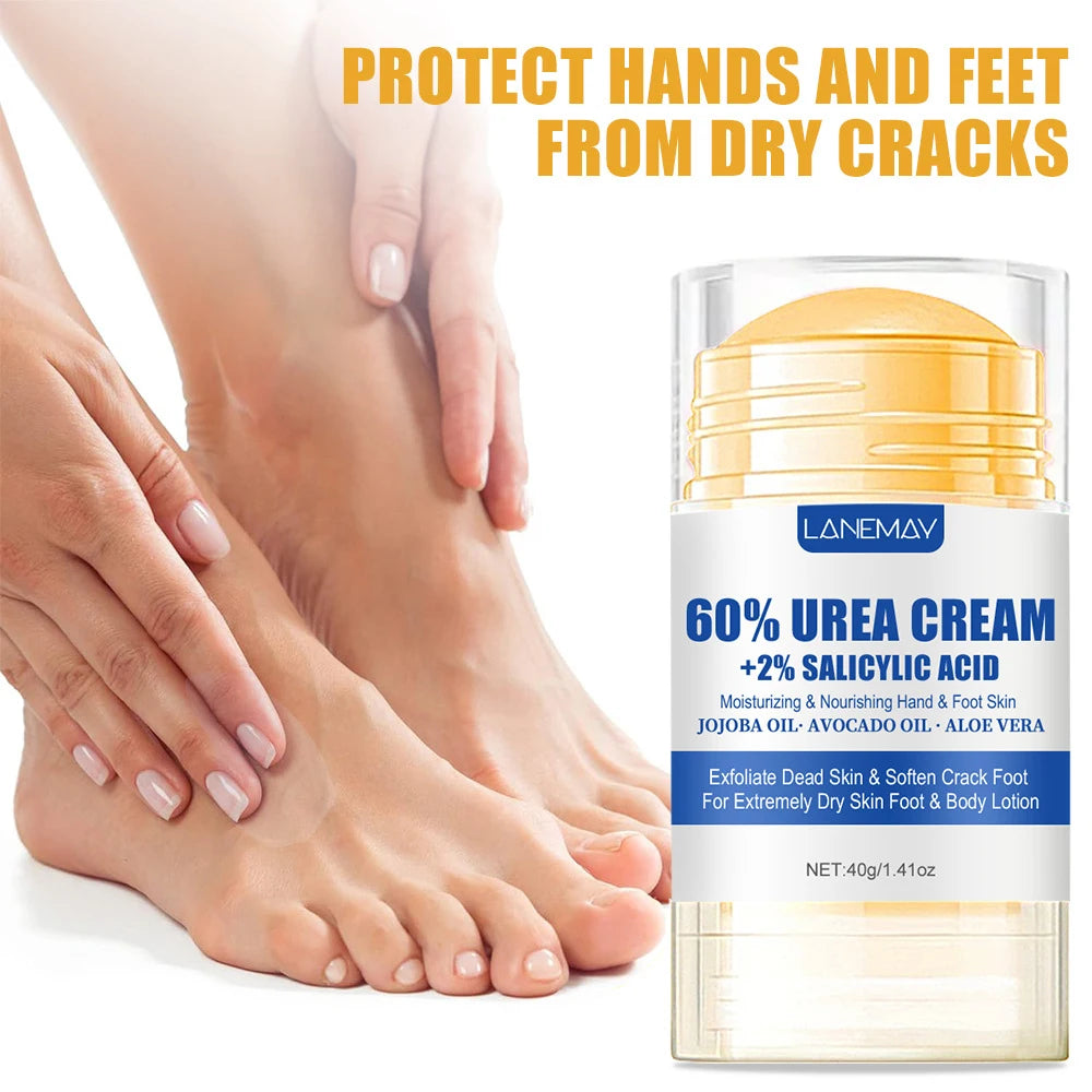 Electric Callus Remover & Repair Cream Kit for Smooth Heels - 11