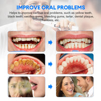 Electric Ultrasonic Teeth Cleaner for Plaque and Tartar Removal